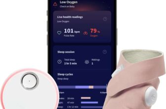 Owlet Dream Sock – Smart Baby Monitor – Prime Exclusive