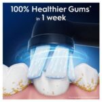 Oral-B iO Gentle Care Toothbrush Heads White