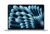Apple MacBook Air 2026, Apple M5 Chip, 16GB RAM, 512GB SSD, 13 Inch Sky Blue, Starlight / 1TB Version All Colours £1149.98